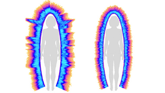 Intenzívne žiarivá aura - vľavo a menej žiarivá aura - vpravo.