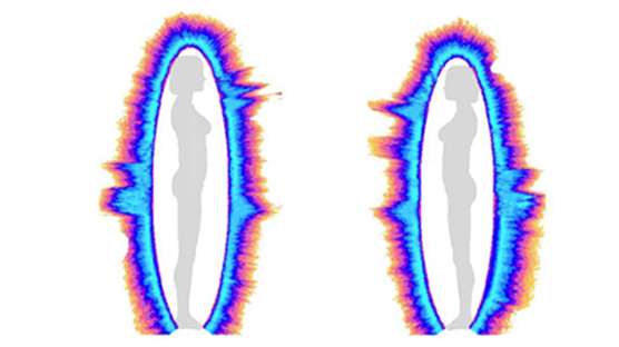 Aura človeka – bočná projekcia. Žena, vek 43 rokov. Výstup z prístroja.